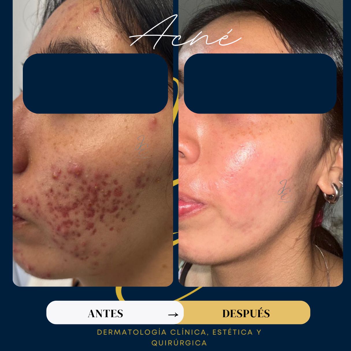 Jeanny Epieyu Diaz-15