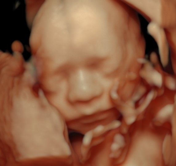 Charles Schwantz De Lima-9