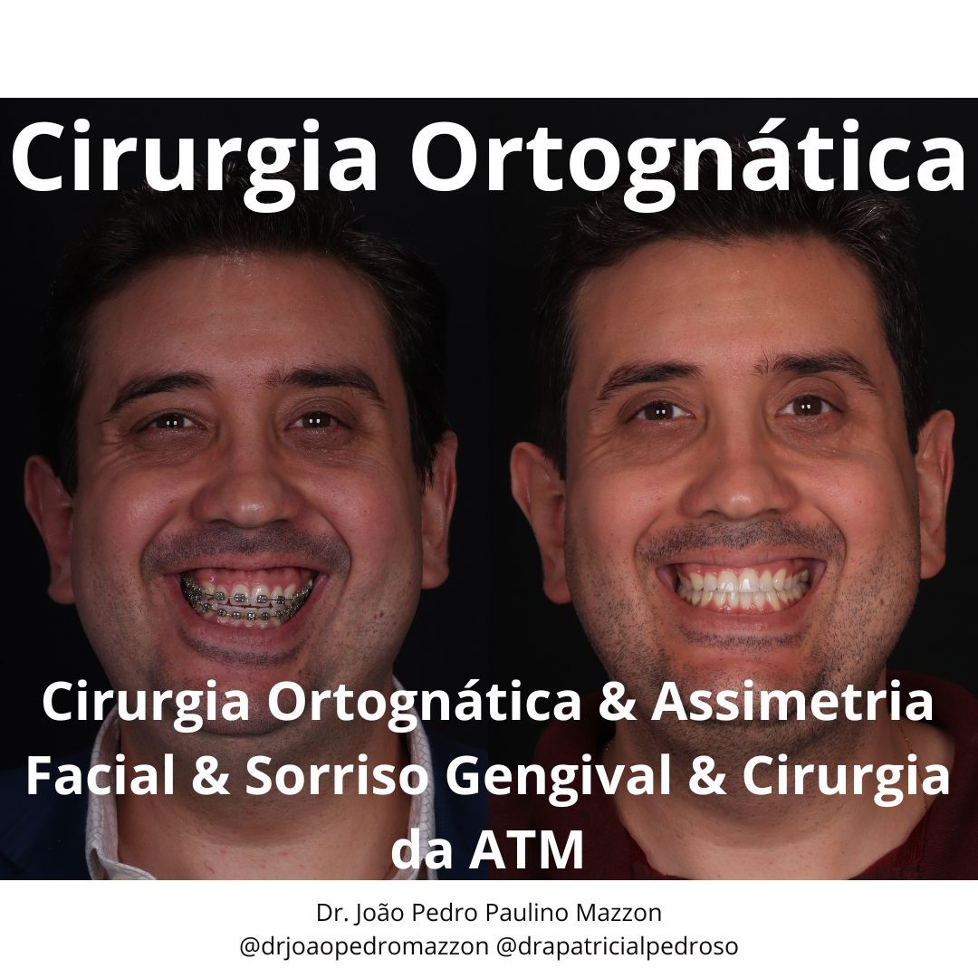 João Pedro Paulino Mazzon-32