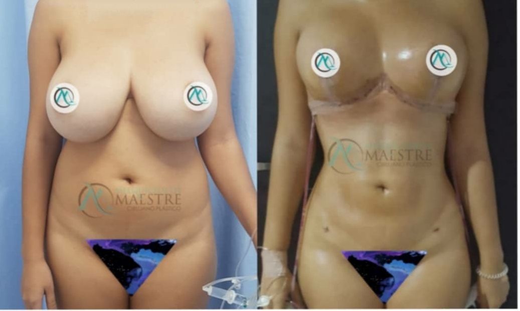 Melquicedeth Maestre-9