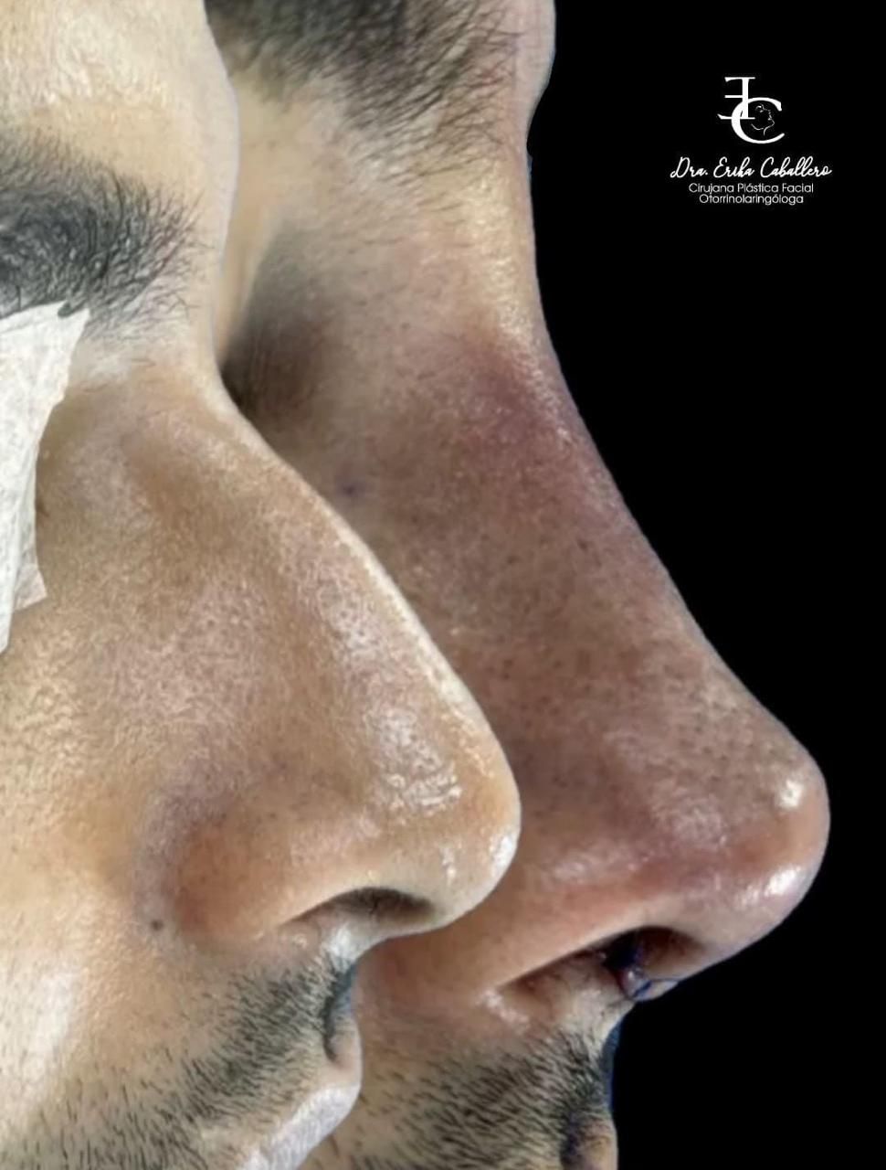 Erika Alexandra Caballero Meneses-6