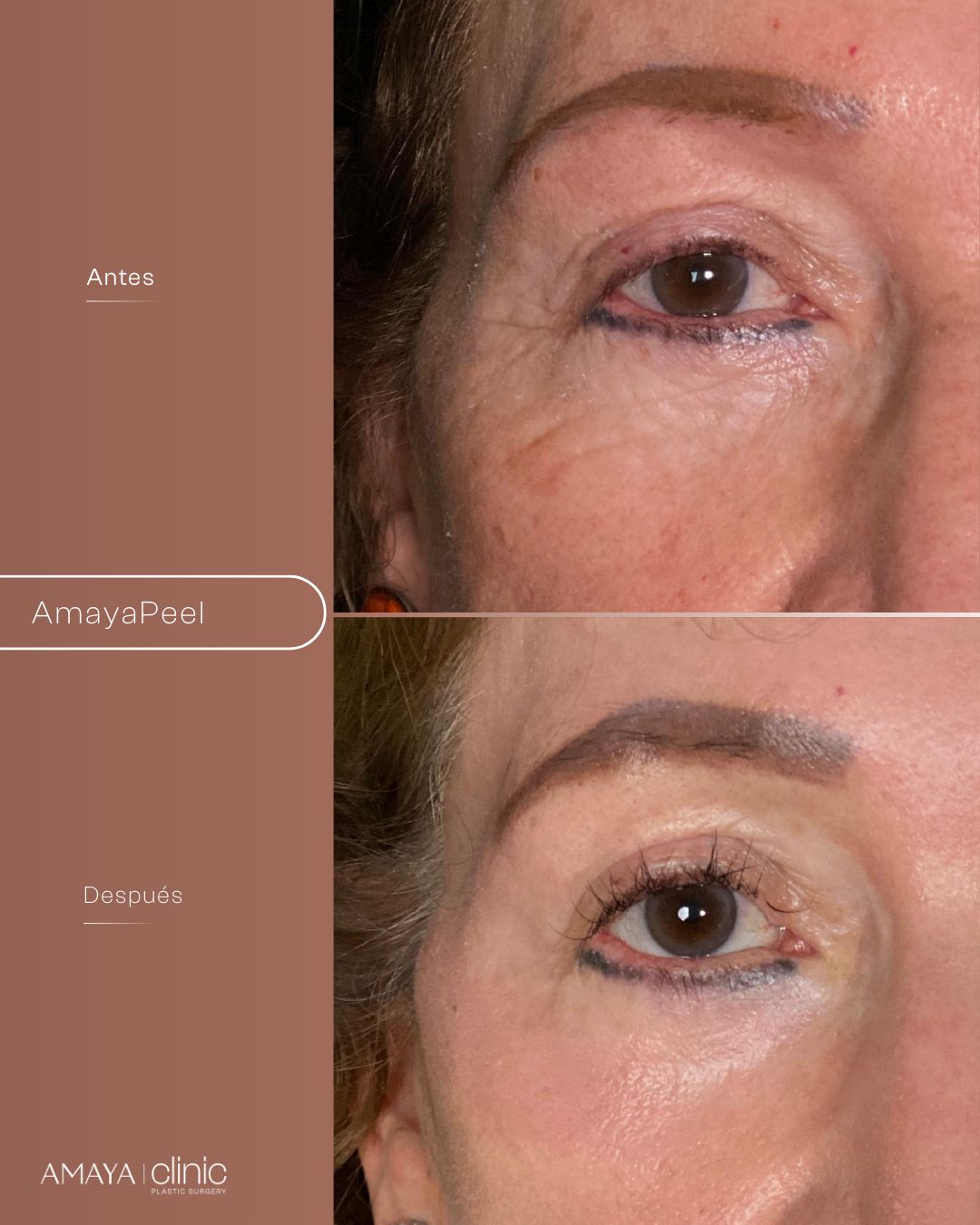 Felipe Amaya Espinosa-12