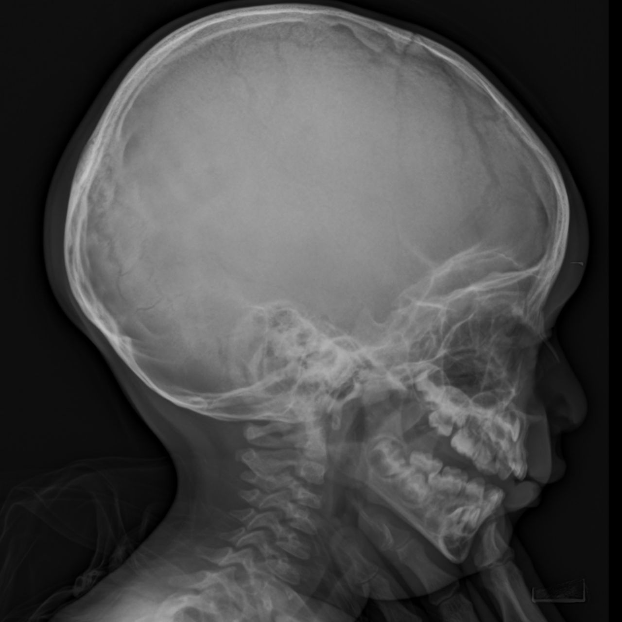 David Tafur Muñoz-1149