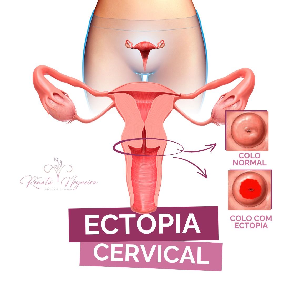 Renata Wanderley Nogueira-3