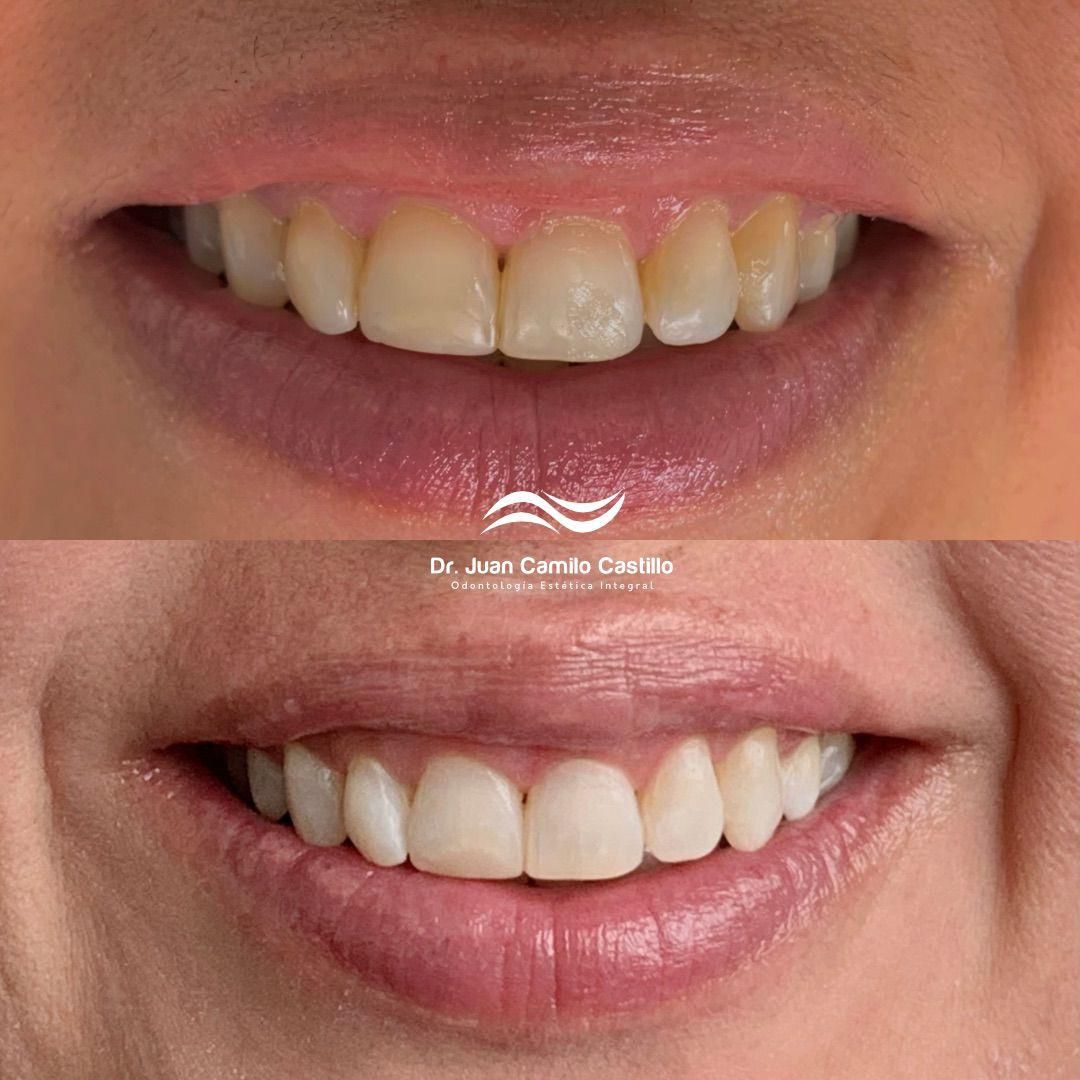 Juan Camilo Castillo-9