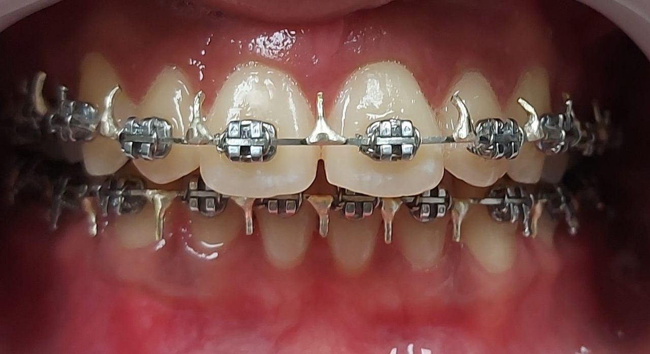 Camila De Loyola E Silva Avellar Fonseca-22