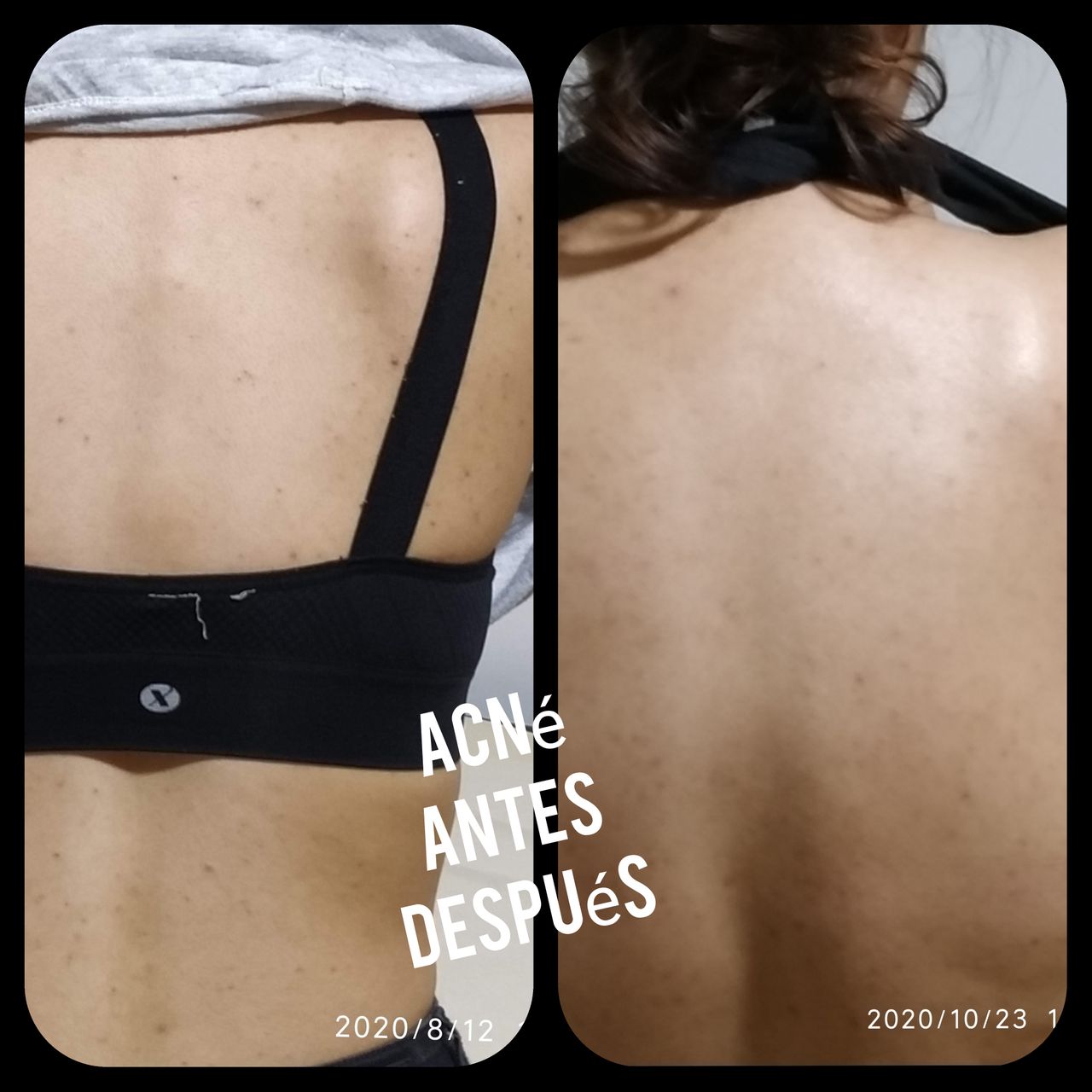 Alejandra Meijide-41