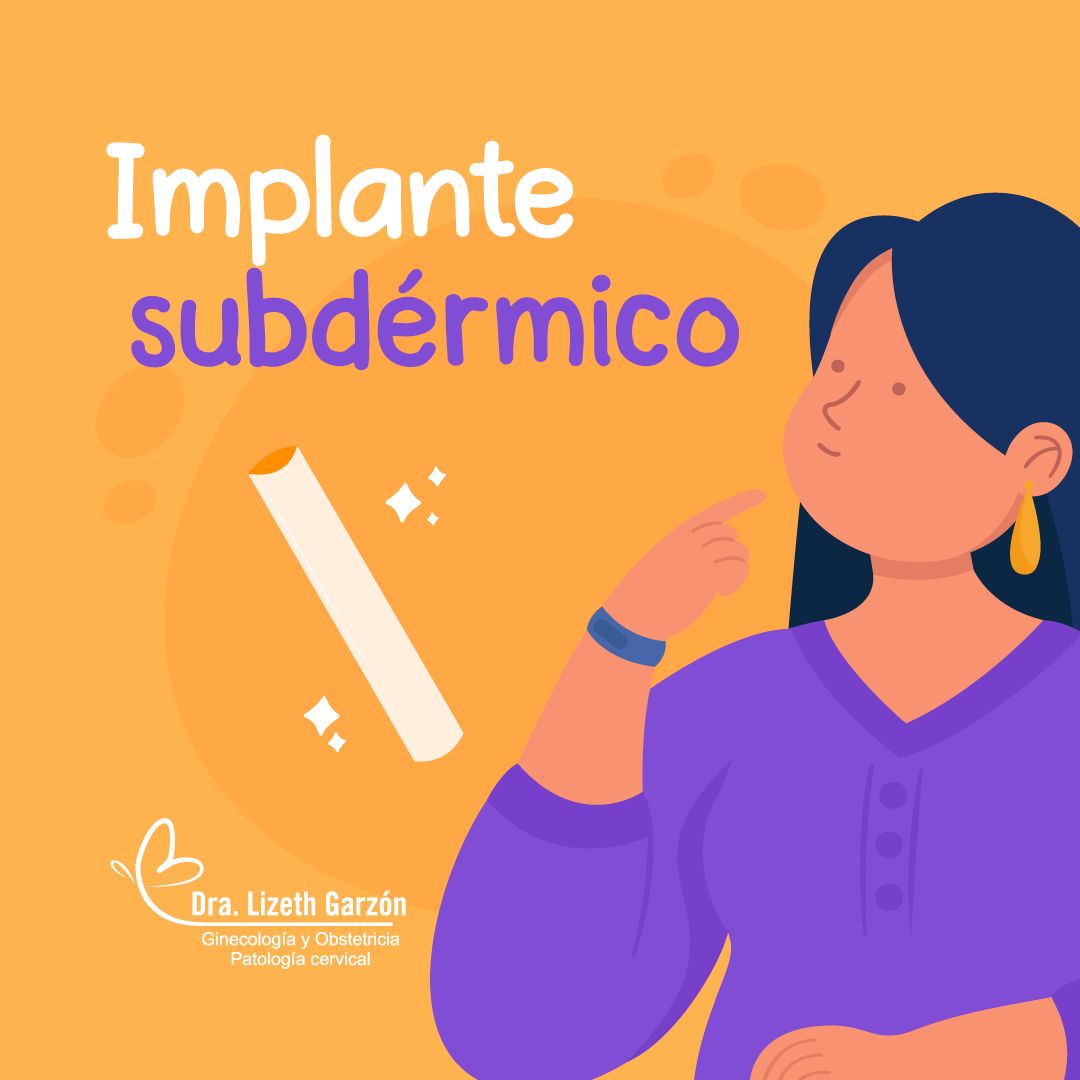 Lizeth Garzon Vargas-31