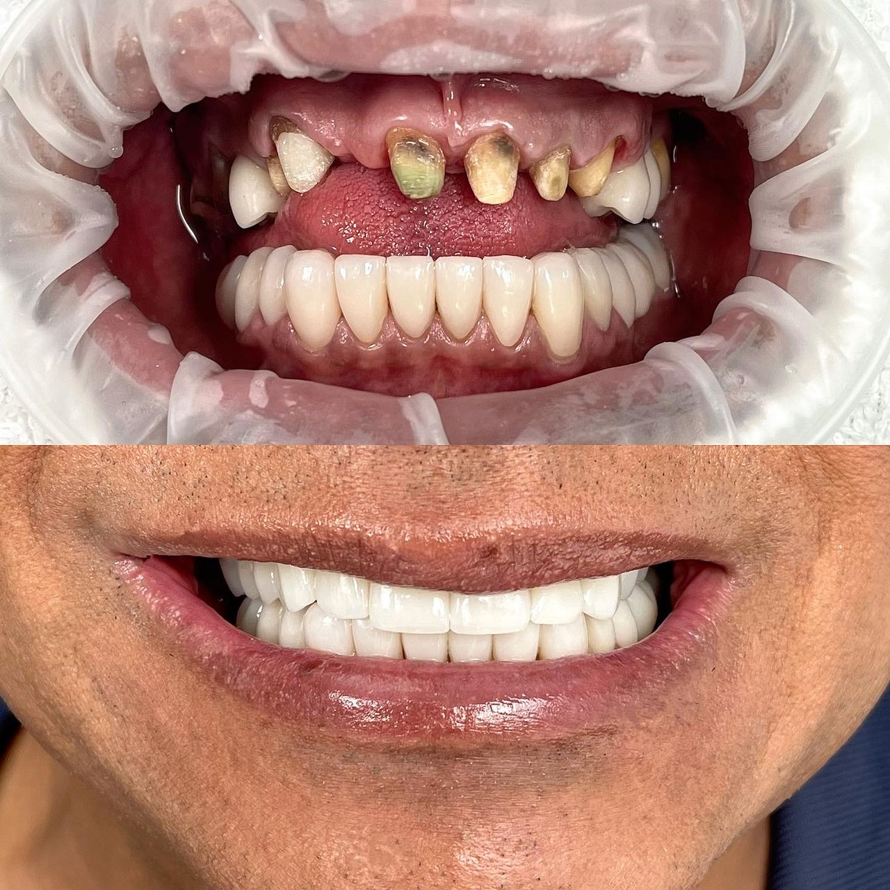 Franci Yulied López Jiménez-5