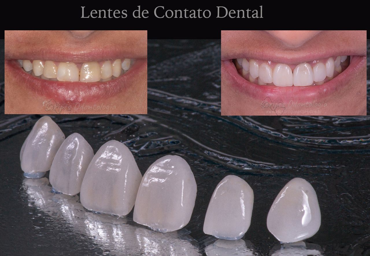 Gabriel Godoy Scripes-73