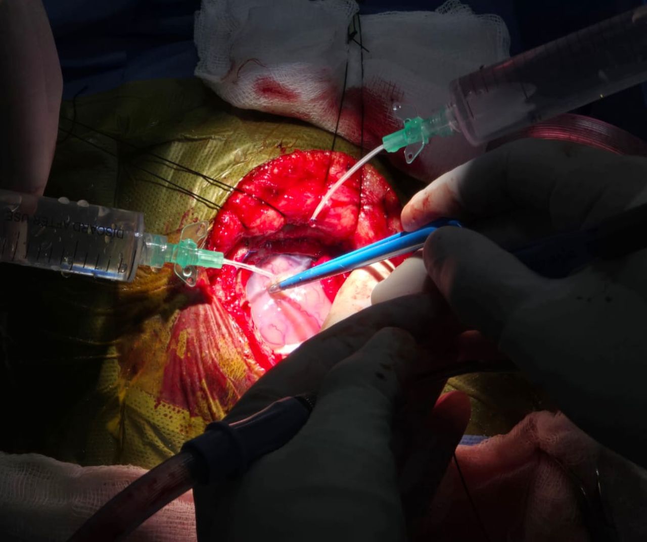 David Tafur Muñoz-1374