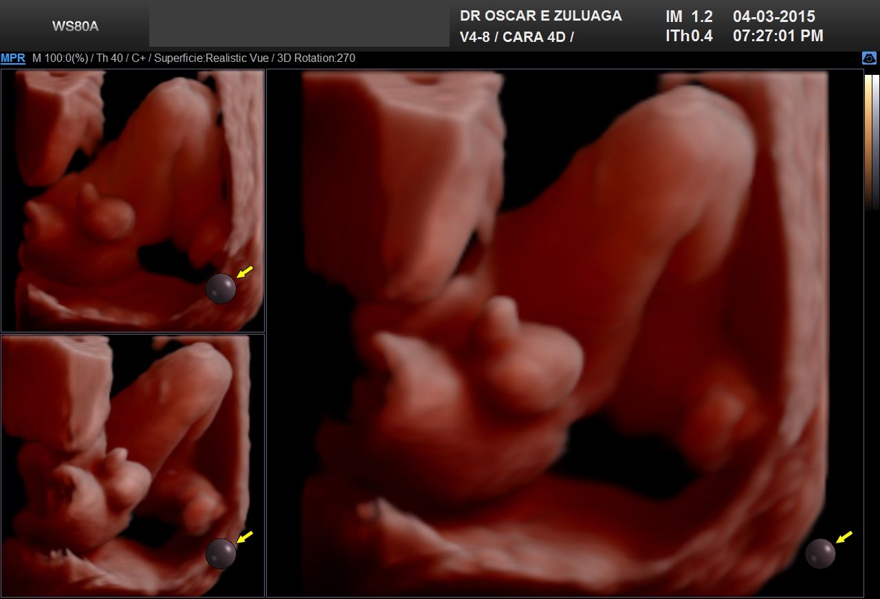 Oscar Elías Zuluaga Cortés-4