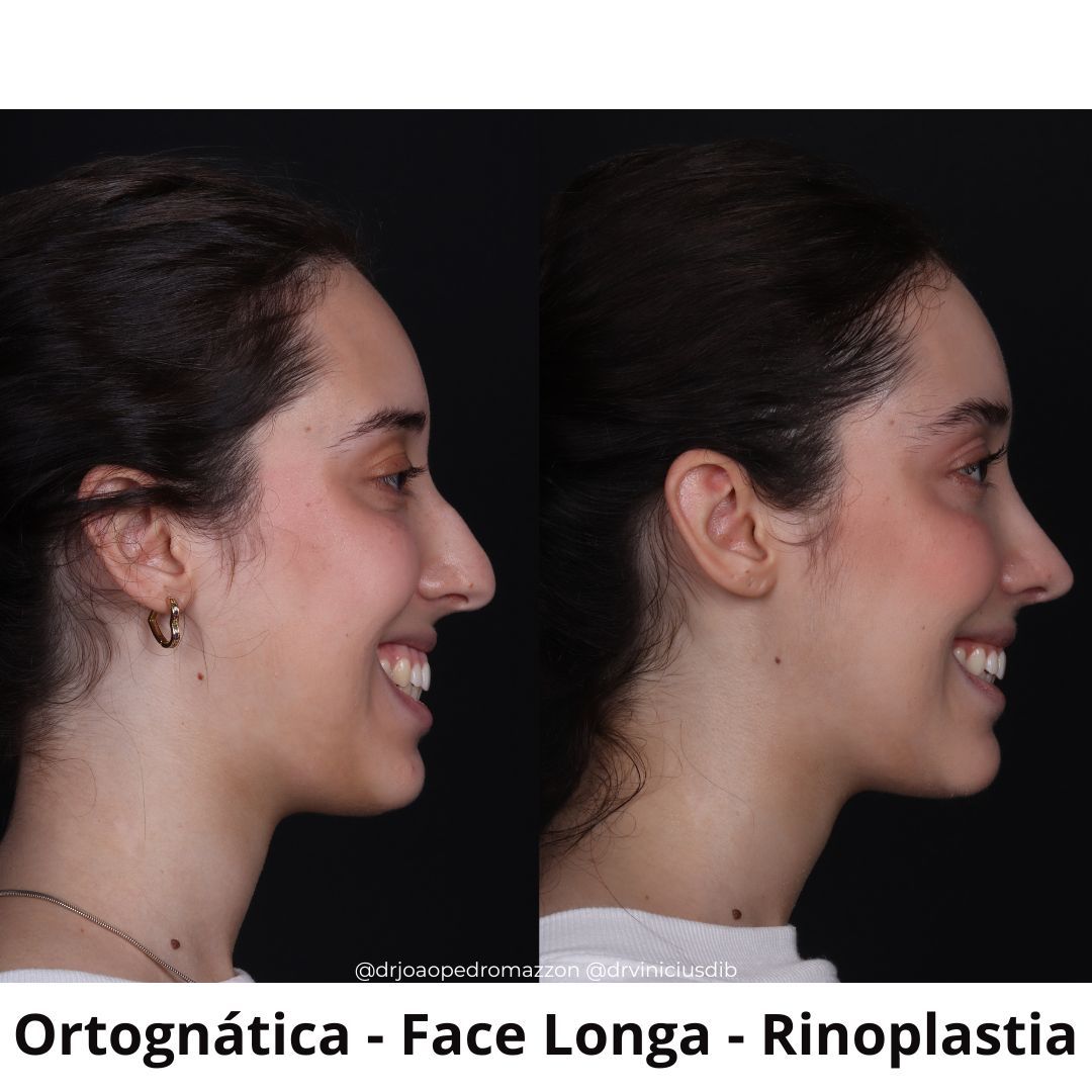 João Pedro Paulino Mazzon-9