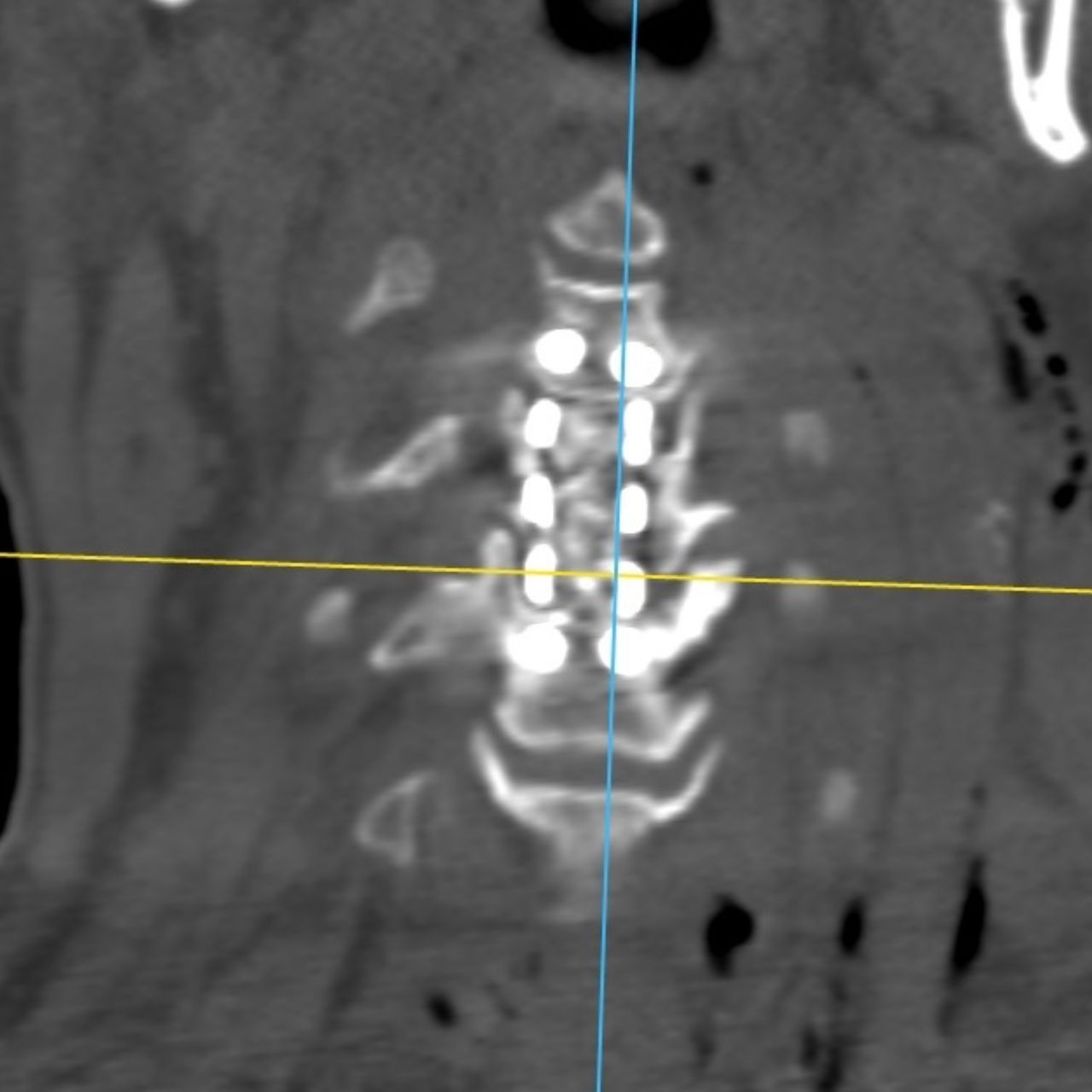 David Tafur Muñoz-1775