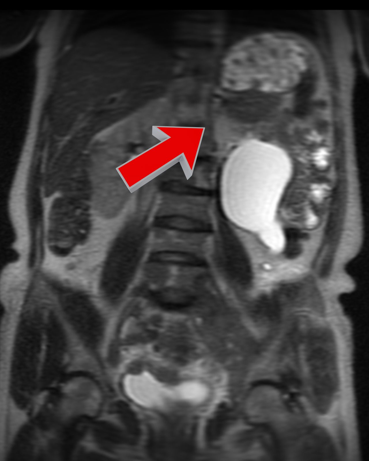 David Tafur Muñoz-2185