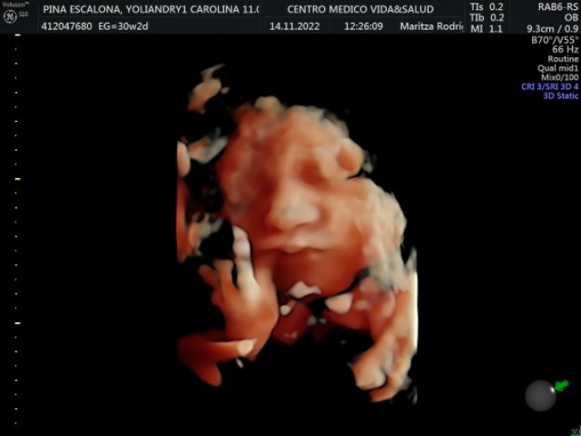 Maritza Rodriguez Balanta-13