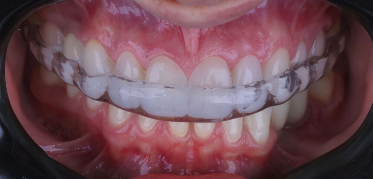 Daniel De Souza Pereira-32