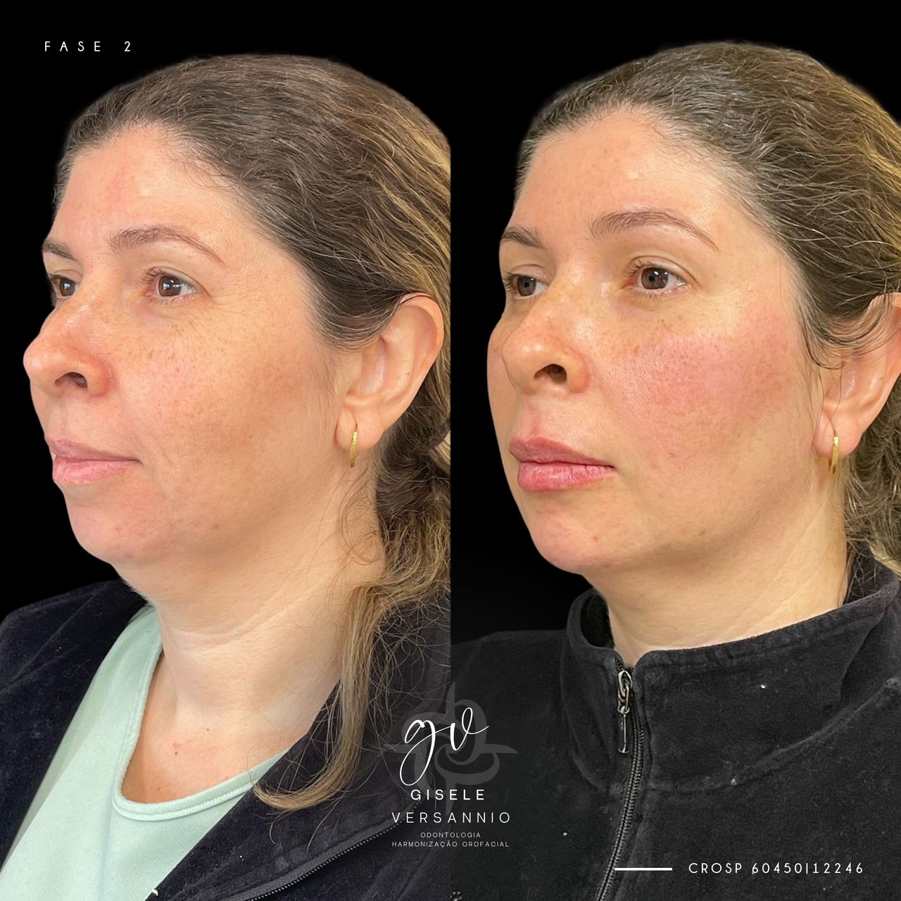 Gisele De Carvalho Versannio-31