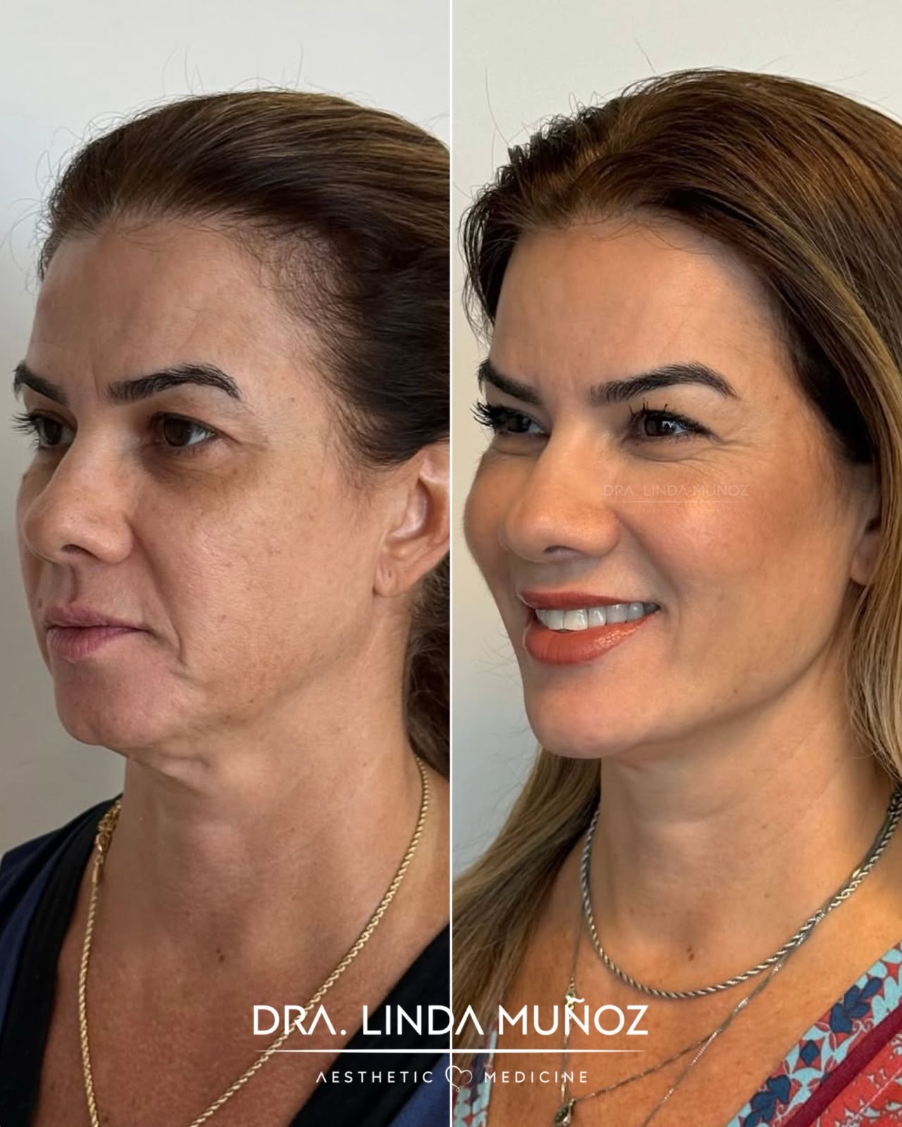 Linda Muñoz-39