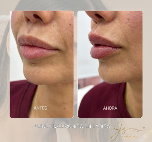 Jasiel Sarai Salas Gomez-1