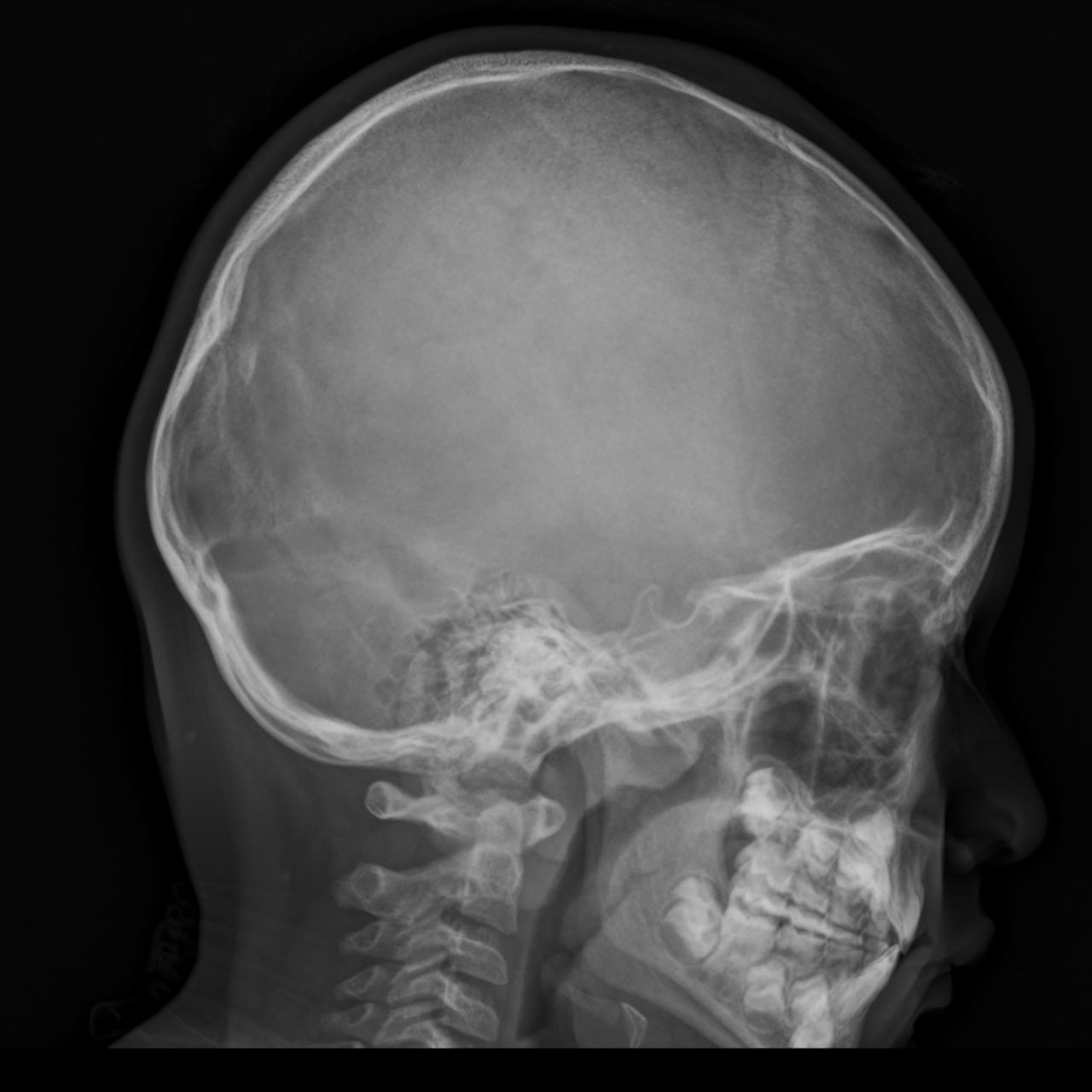 David Tafur Muñoz-1150