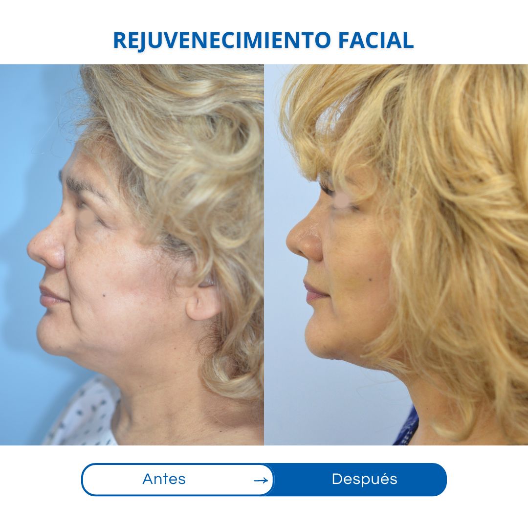 Otto Enrique Ziegler Gutierrez-3