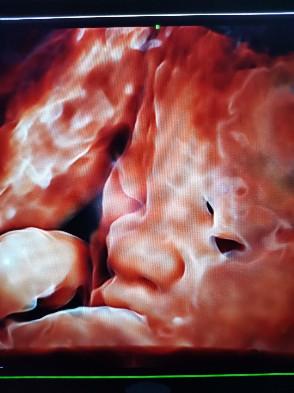 Marcelo Fierro Jarrin-11