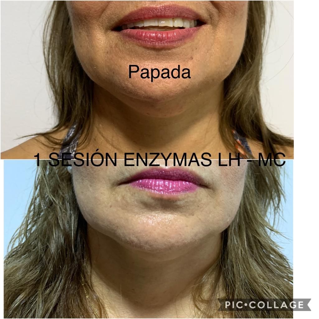 Maria Gisela Angel Losada-79