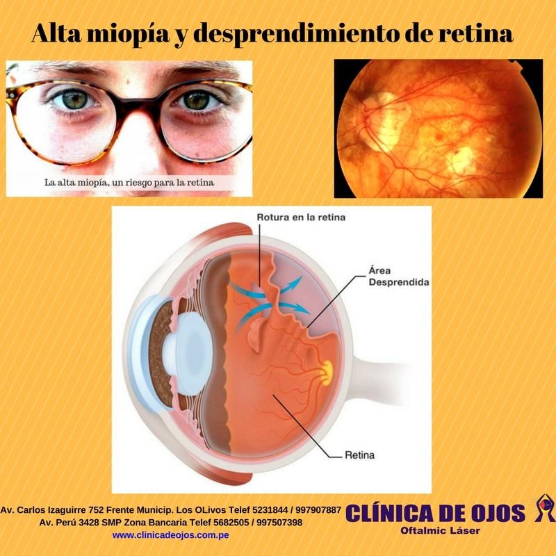 Edgar Angel Hidalgo Pecho-18