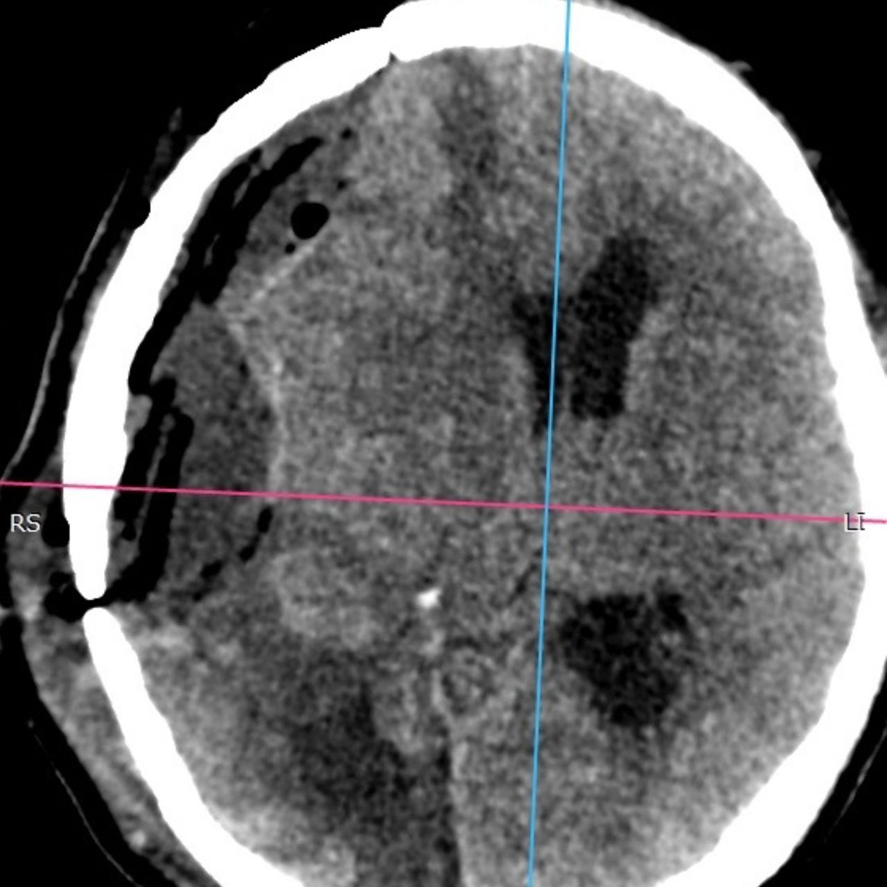 David Tafur Muñoz-1384