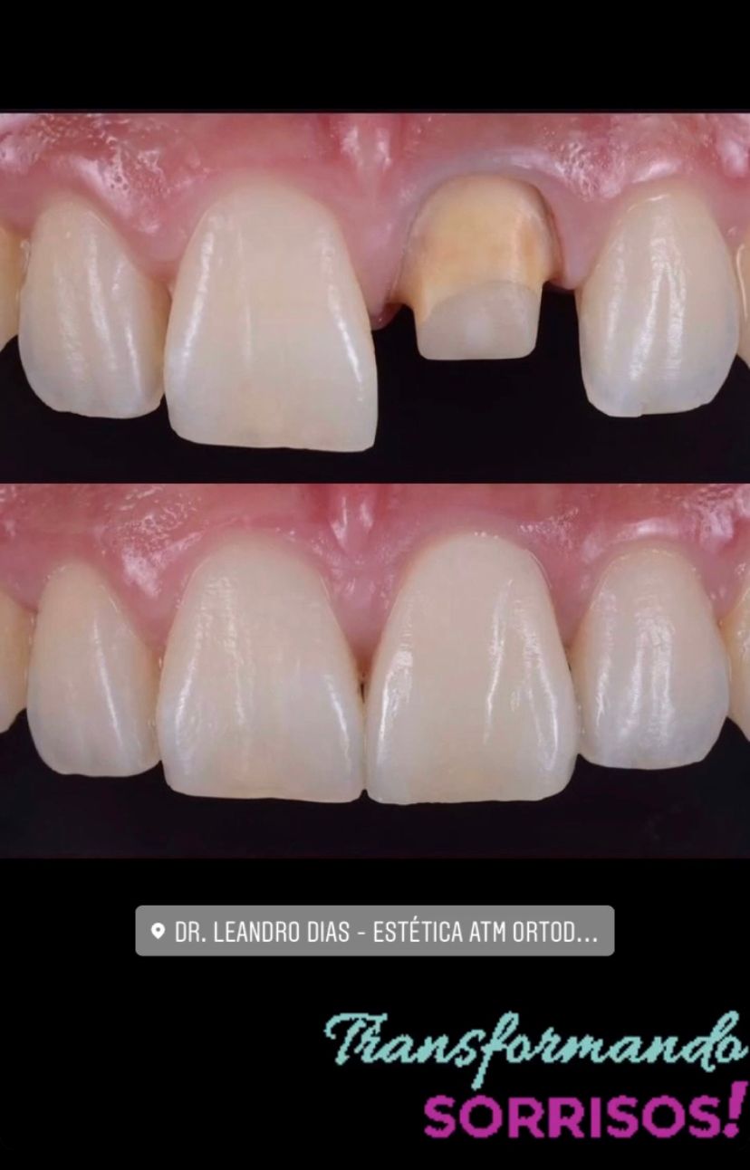 Leandro Ponte Dias-12