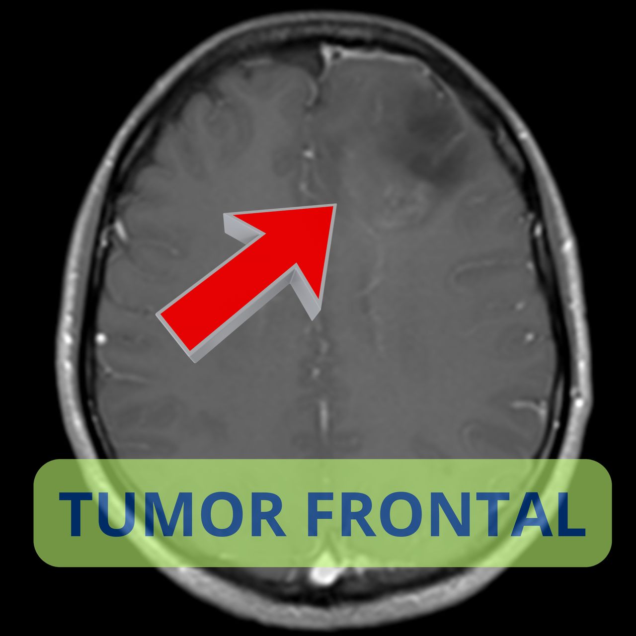 David Tafur Muñoz-2268