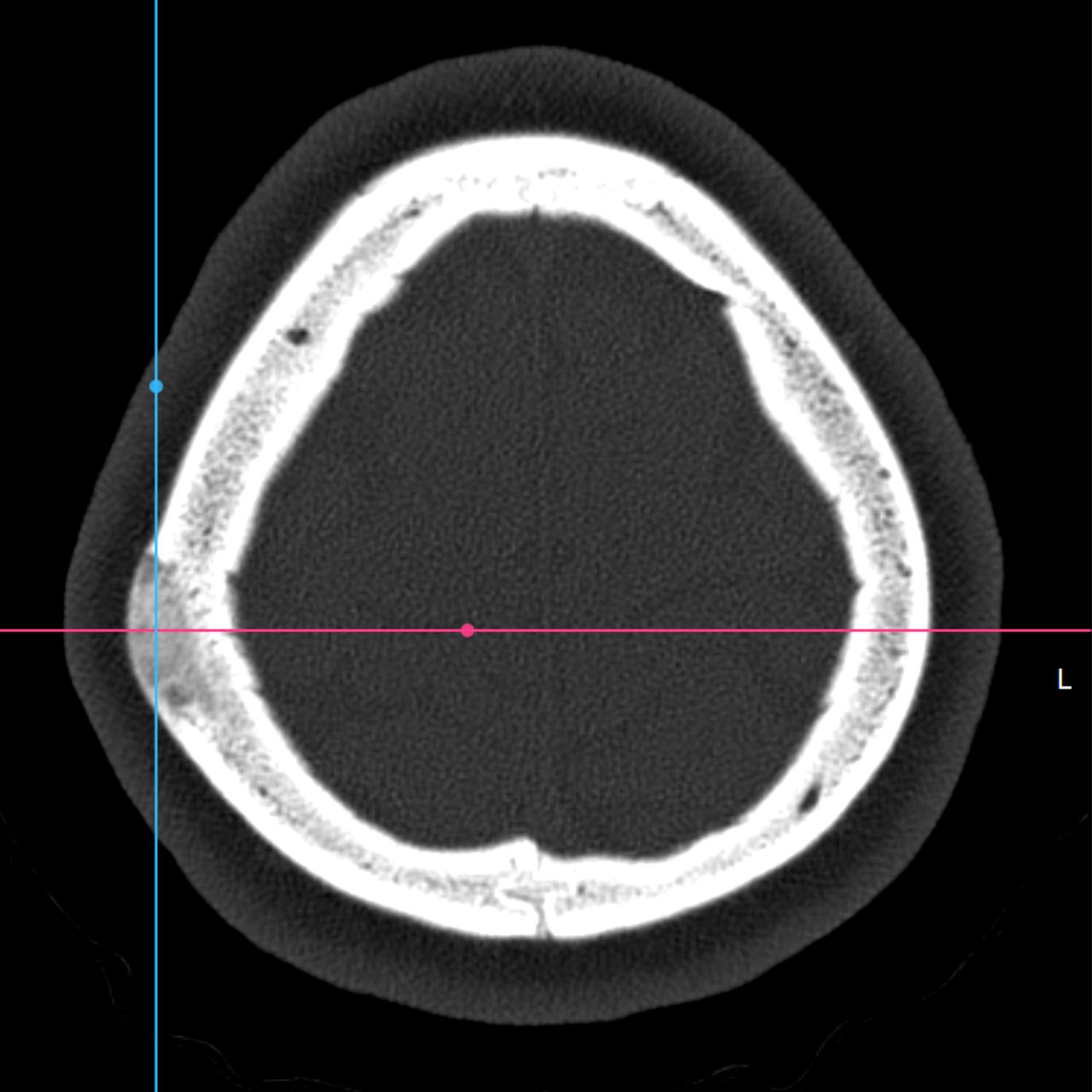 David Tafur Muñoz-2295