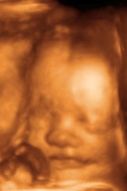 Diego Hernando Diaz Botero-5