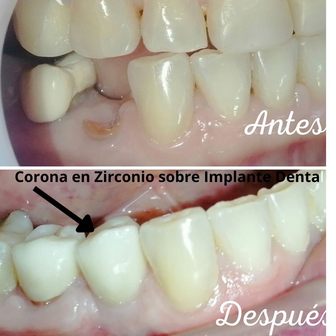 Martha Liliana Millan Diaz-42