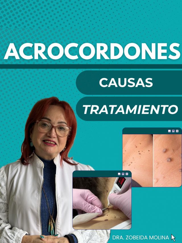 Zobeida Molina-6
