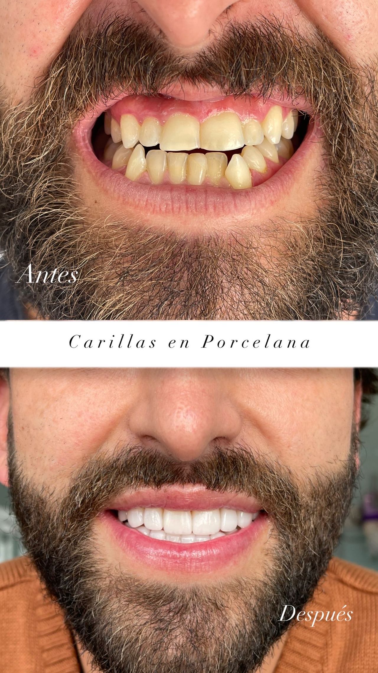 Franci Yulied López Jiménez-3