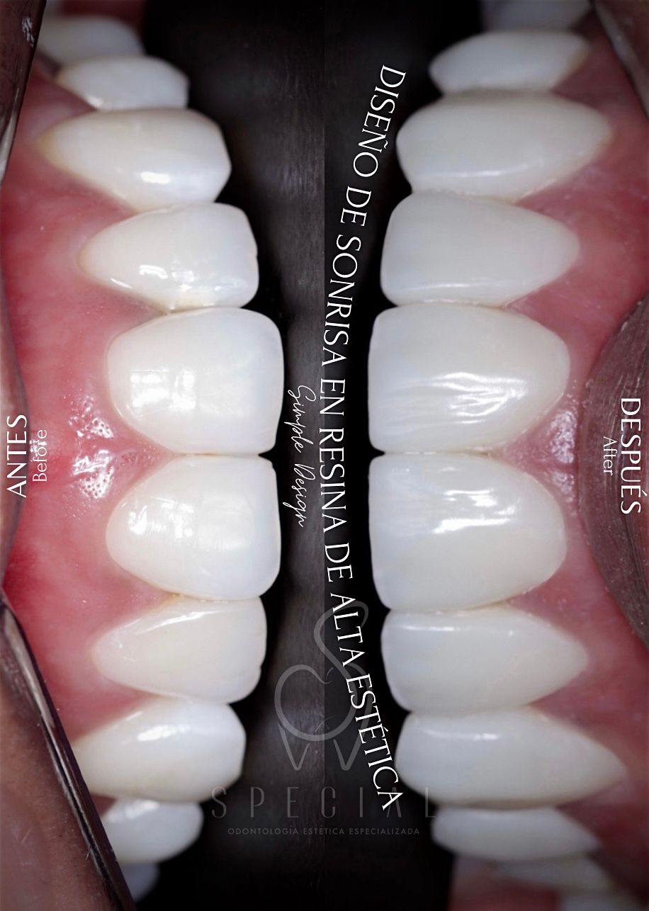 Miguel Dario Charfuelan I.-3