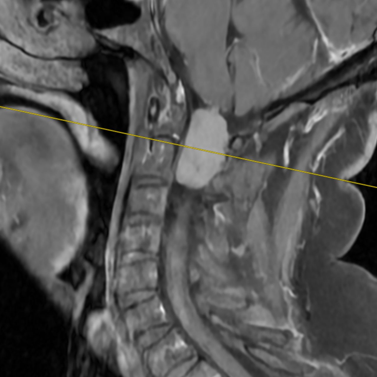 David Tafur Muñoz-3689