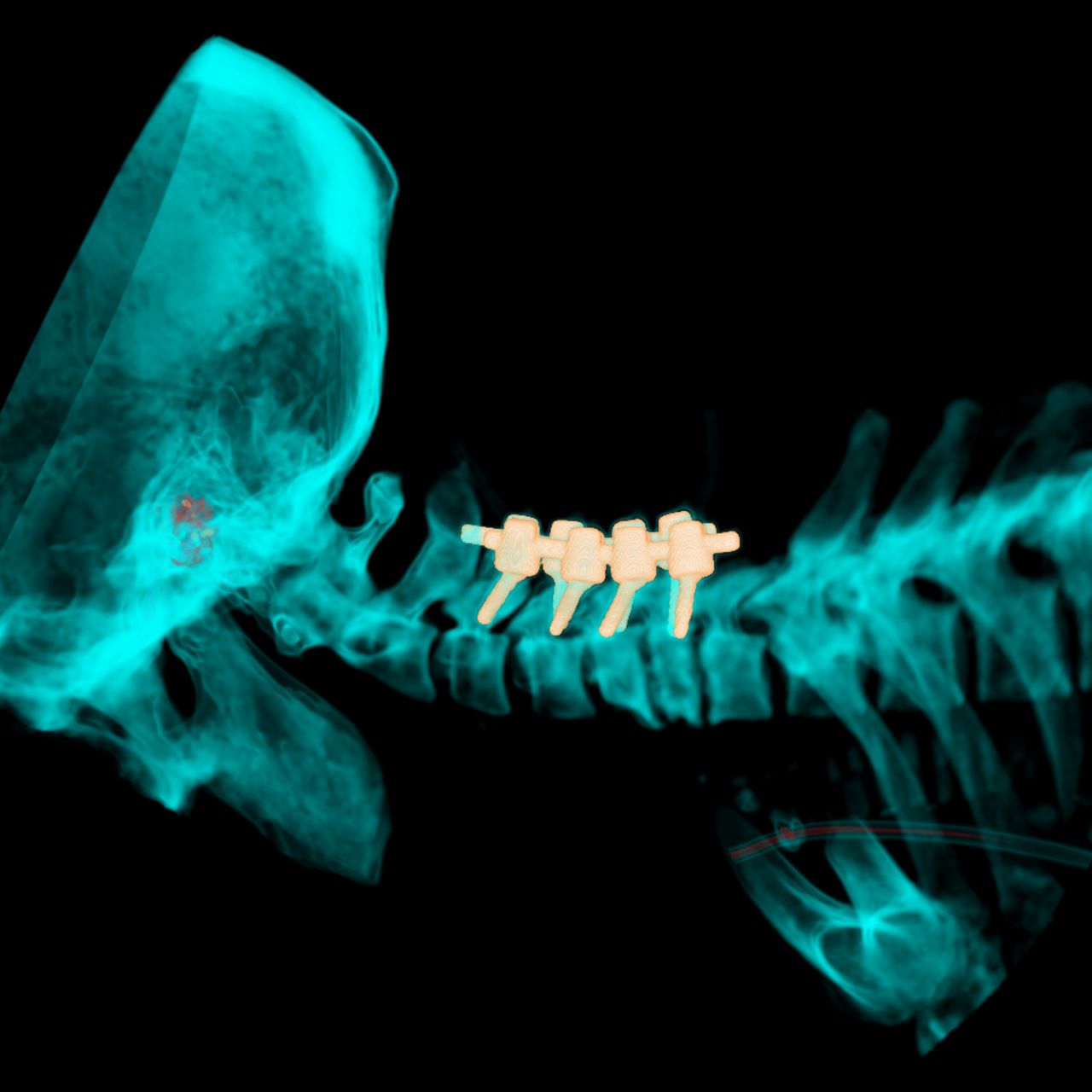 David Tafur Muñoz-1958