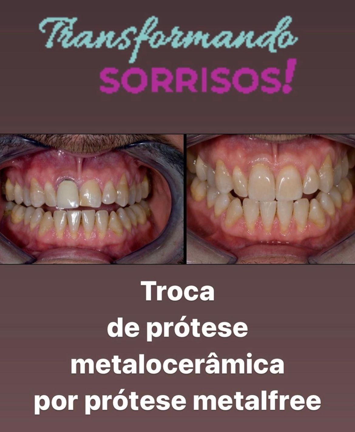 Leandro Ponte Dias-9