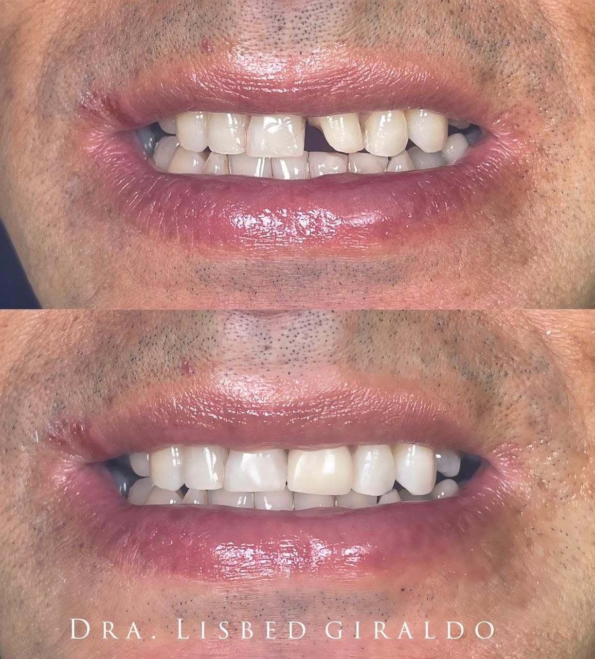 Lisbed Giraldo Olarte-29