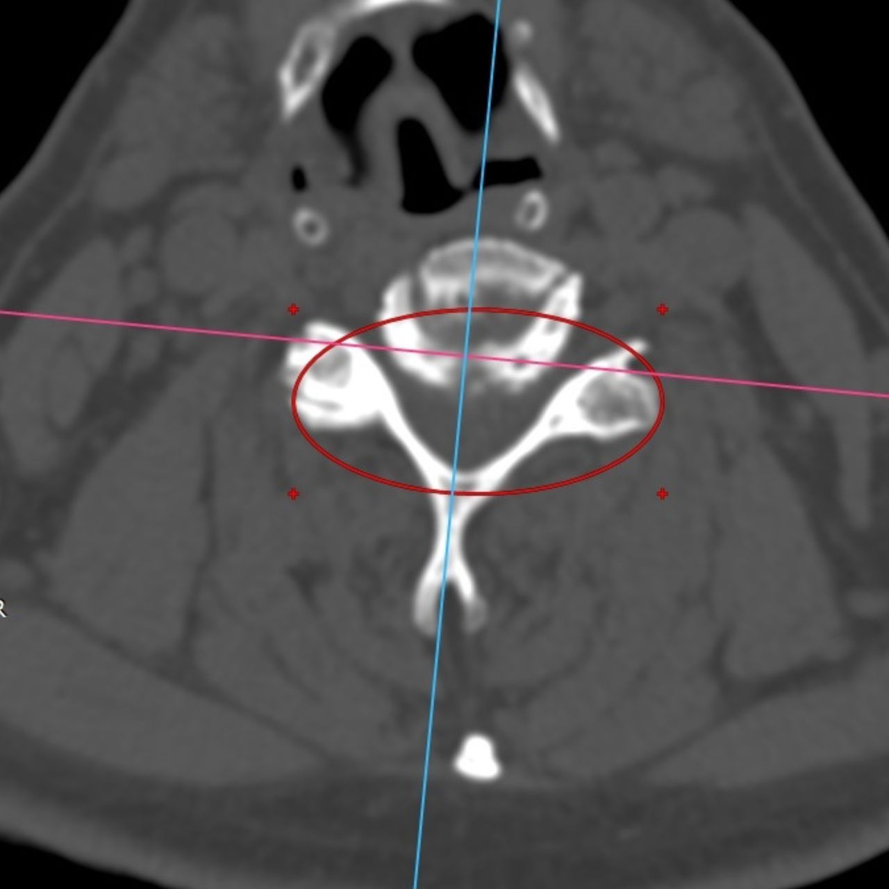 David Tafur Muñoz-1766