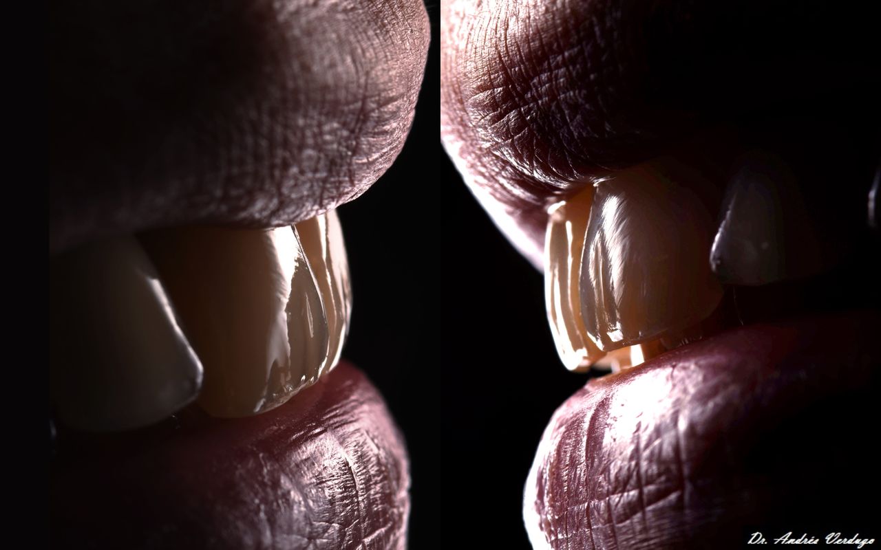 Andrés Verdugo Bolumburu-11