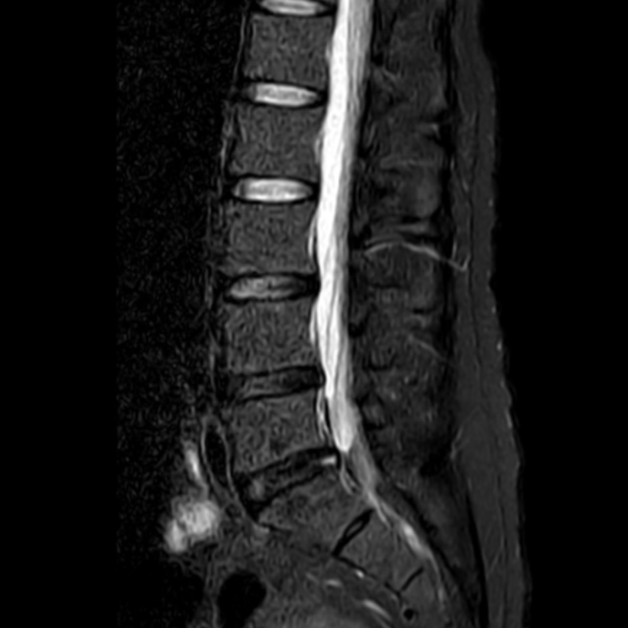 David Tafur Muñoz-1953