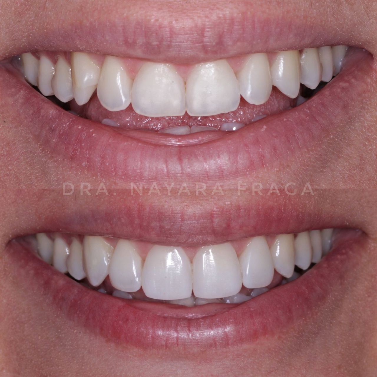 Nayara Fraga De Miranda-5