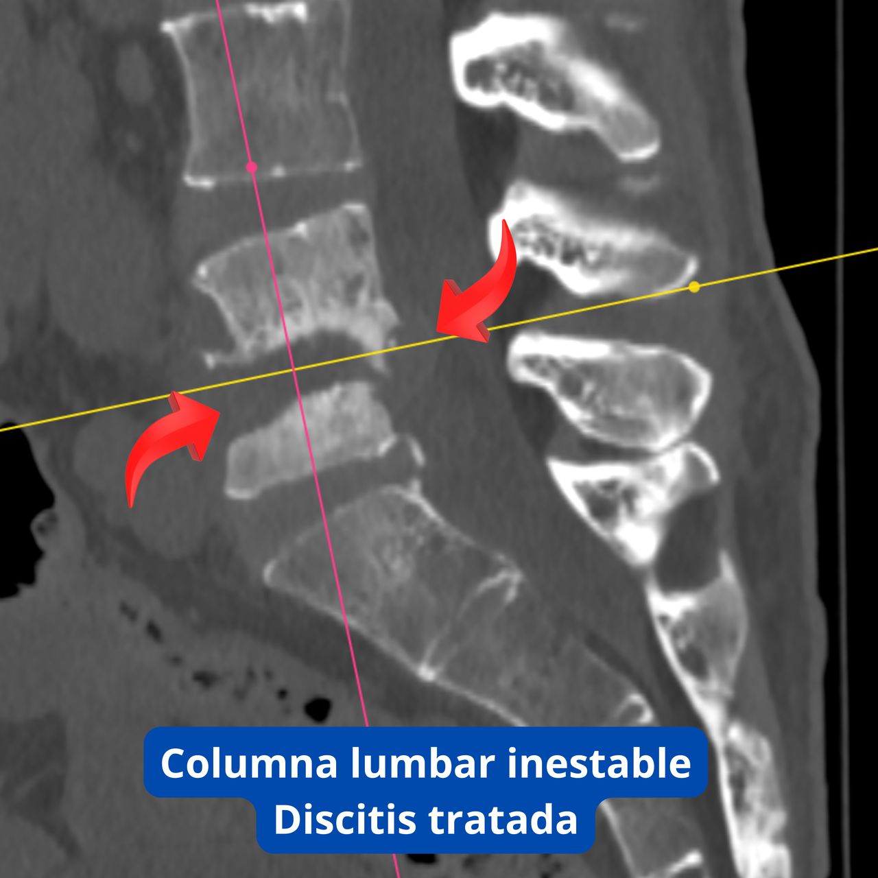 David Tafur Muñoz-1850