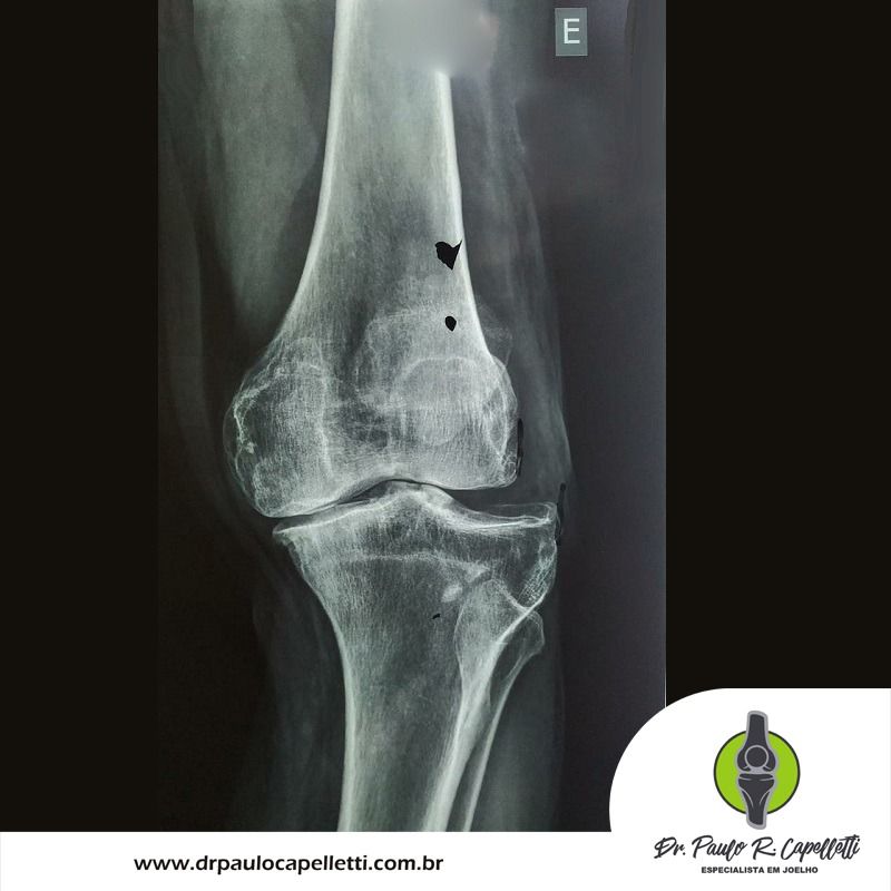 Paulo Roberto Capelletti-68