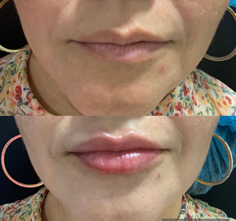 Maria Gisela Angel Losada-5