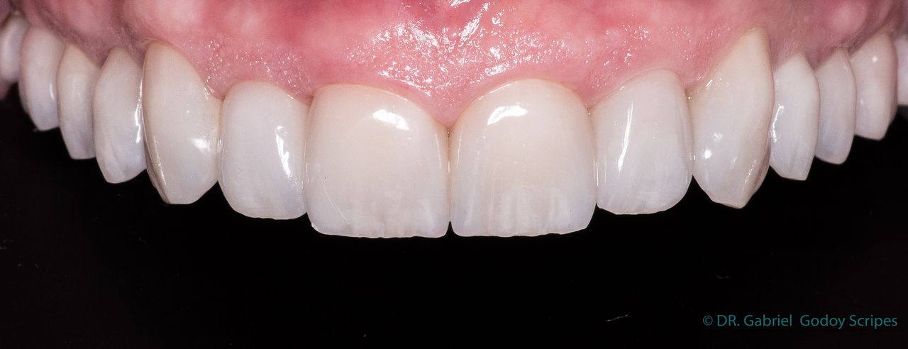 Gabriel Godoy Scripes-82